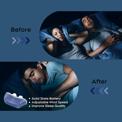 Anti-Snoring Nasal Device — Silicone Sleep Aid for Better Breathing