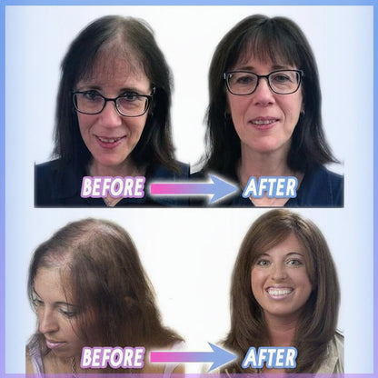 Clip-In Hair Topper for Instant Volume and Natural-Look Coverage of Thinning Hair