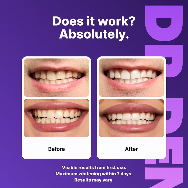 PureSmile™ Whitening Strips