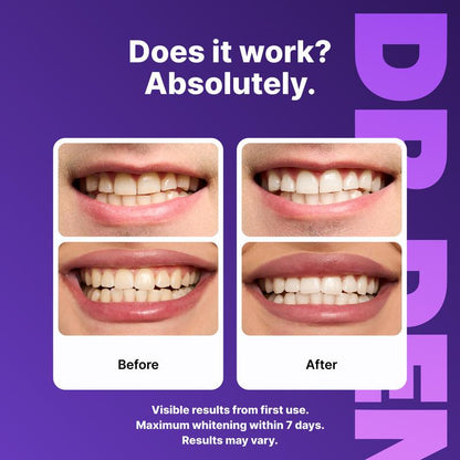PureSmile™ Whitening Strips