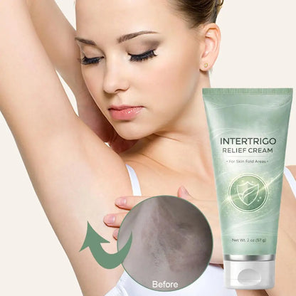 1pc 57g Skin Abrasion Cream Soothing Non-Greasy Lotion Underarm Cream for Women Men Friction Reduction Moisturizing Underarm