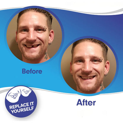 Cosmetic Teeth Veneer Cover Set - Enhance Your Smile