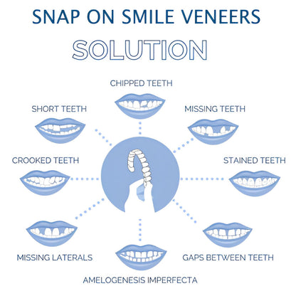 Cosmetic Teeth Veneer Cover Set - Enhance Your Smile