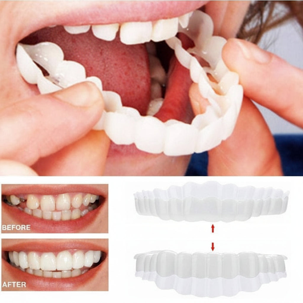 Affordable Removable Teeth Veneers for a Natural-Looking Smile