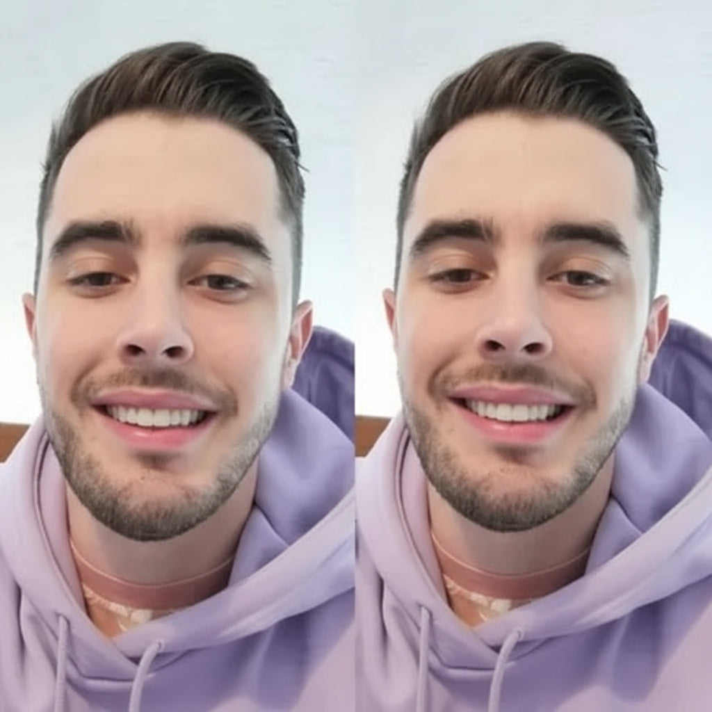 Affordable Removable Teeth Veneers for a Natural-Looking Smile