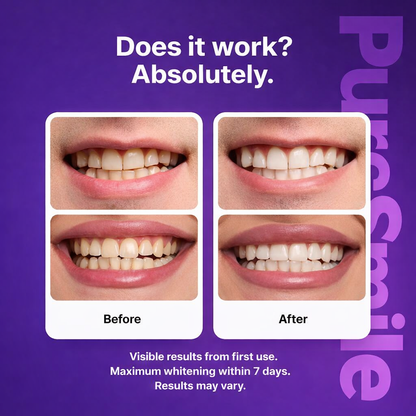 PureSmile™ Whitening Strips