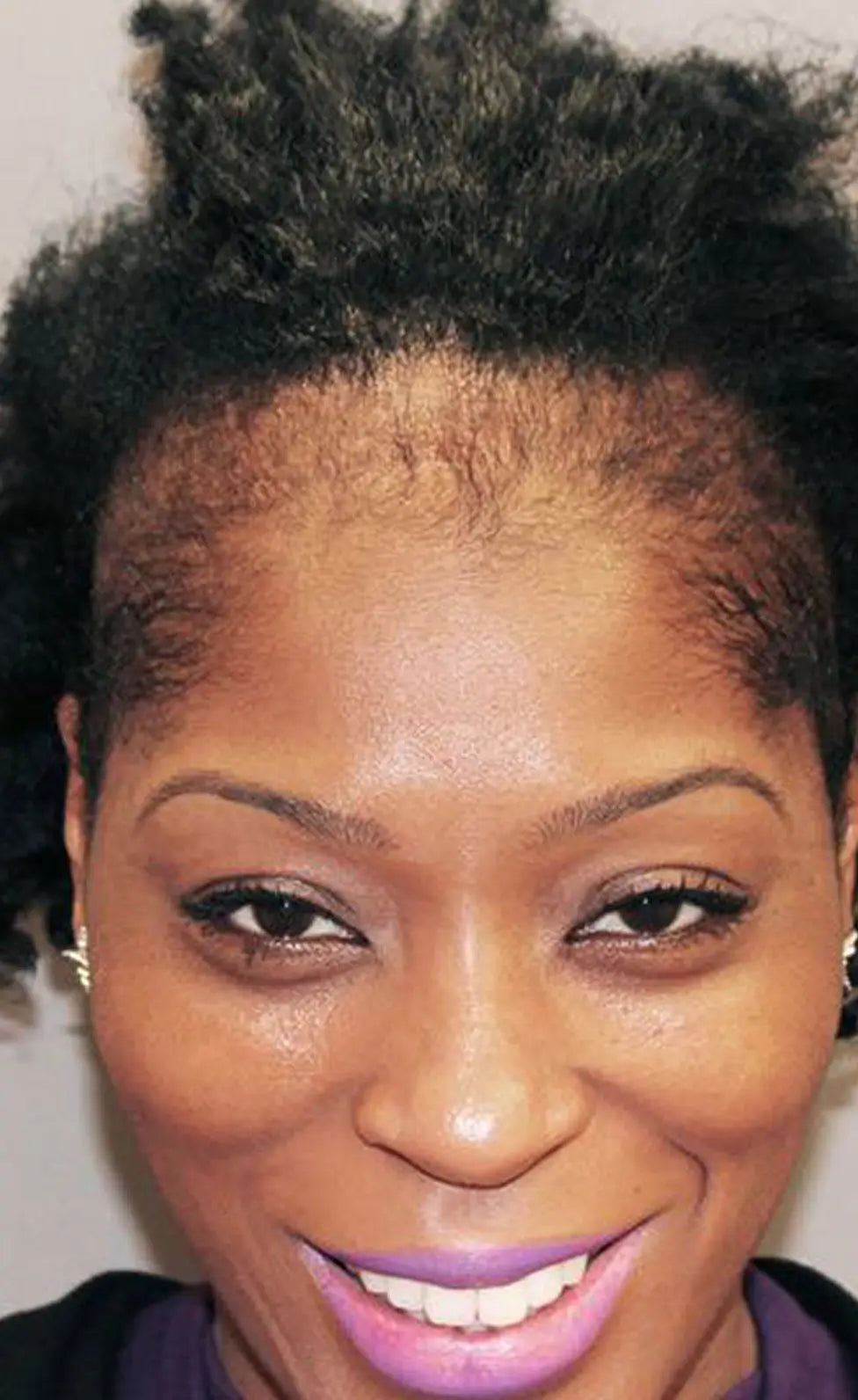 Batana Natural Hair Growth Oil