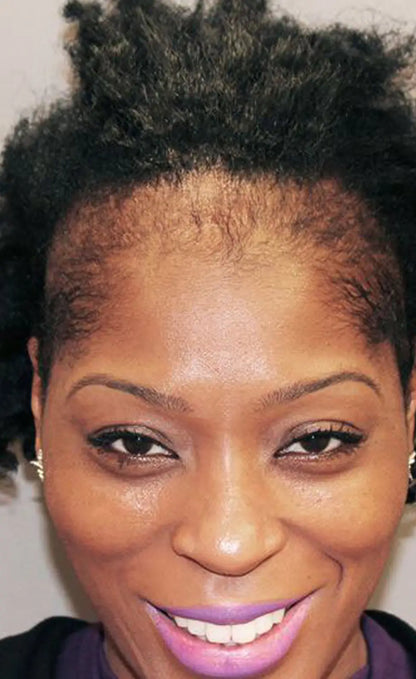 Batana Natural Hair Growth Oil