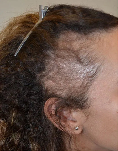 Batana Natural Hair Growth Oil