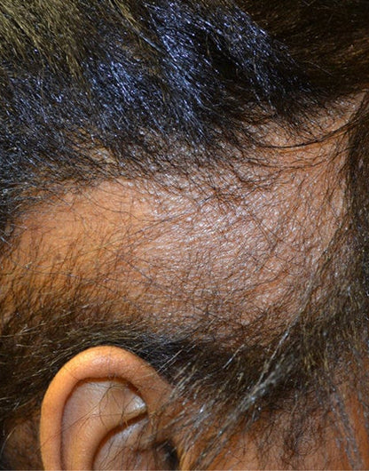 Batana Natural Hair Growth Oil