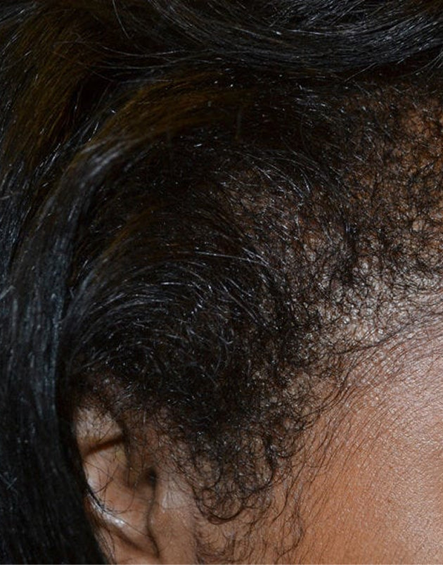 Batana Natural Hair Growth Oil