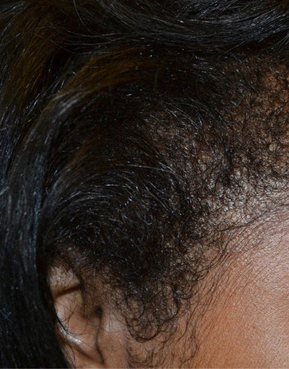 Batana Natural Hair Growth Oil