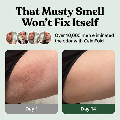 CalmFold™ Anti-Fungal Relief Cream